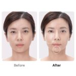 دستگاه جوان ساز Booster Pro مدی کیوب نتیجه