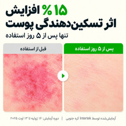 تست سرم تسکین دهنده PDRN و آلوئه ورا اکوال بری