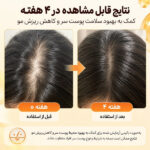سرم کف سر محرک رشد مو Growturn لیلیوئه - تصویر 2