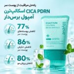 تاثیر سرم کف سر موی سیکا و PDRN لیلیوئه